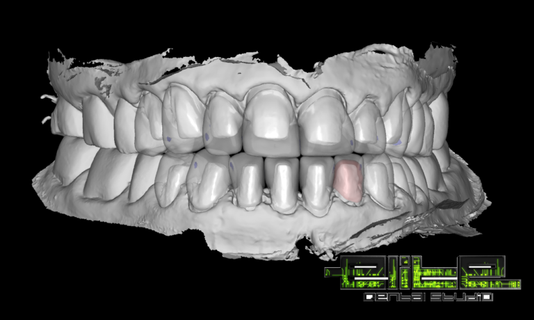 #elitedentalstudio #dentallab #dentallaboratory 1.2