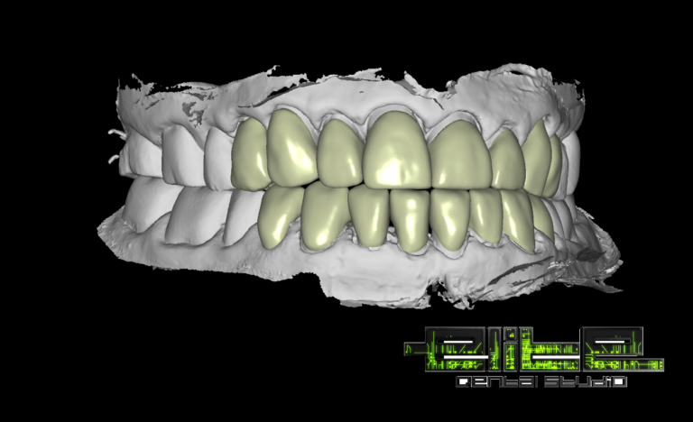 #elitedentalstudio #dentallab #dentallaboratory 1.3